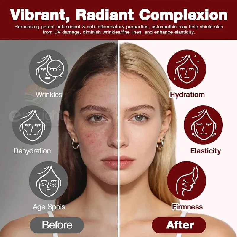 Astaxanthin 24mg – Potent Antioxidant for Skin Eyes & Immune Health – 10-in-1 with Lycopene Grape Seed Vitamin E & Zinc — image 3