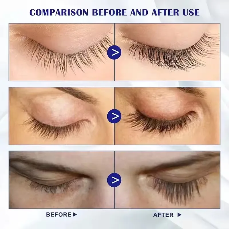 Serum Pertumbuhan Bulu Mata Cepat 7 Hari Penambah Kening Bulu Mata Asli Lebih Lama Penuh Lebih Lebat Bulu Mata Produk Rawatan Makeup Penjagaan Mata